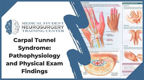 medical diagnosis in tagalog|Use of a remote assessment pathway for diagnosis of carpal .